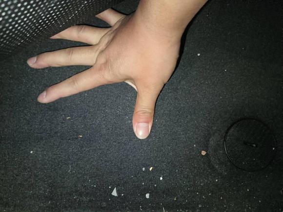 [嘉兴·浙F] 二手宝马宝马5系2017款 525Li 领先型