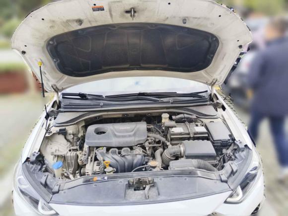 [嘉兴·浙F] 二手现代领动2016款 1.6L 自动智炫·精英型