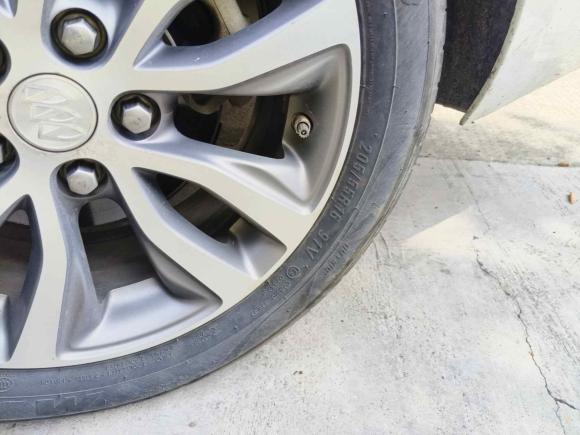 [嘉兴·浙F] 二手别克英朗2018款 18T 自动精英型