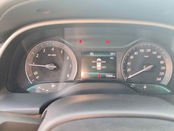 [深圳·粤L] 二手别克英朗2016款 15N 手动豪华型