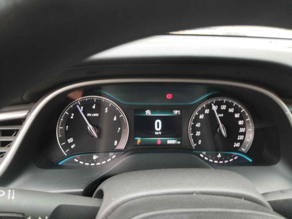 [金华·浙G] 二手别克英朗2015款 15N 自动豪华型