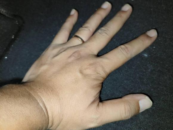 [合肥·皖A] 二手别克君越2018款 20T 豪华型