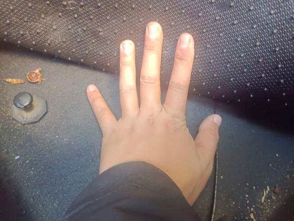 [金华·浙G] 二手现代瑞纳2010款 三厢 1.4L 自动时尚型GT