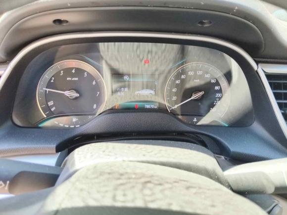 [嘉兴·浙F] 二手别克英朗2016款 15N 自动精英型