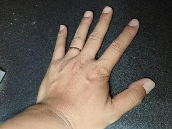 [合肥·皖A] 二手现代朗动2016款 1.6L 自动智能型