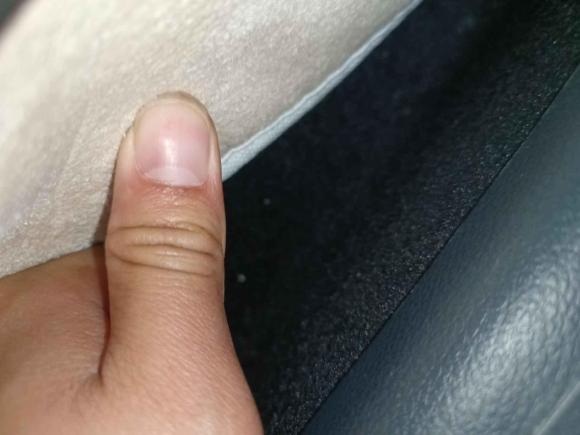 [苏州·苏E] 二手奔驰奔驰GLA2018款 GLA 200 动感型