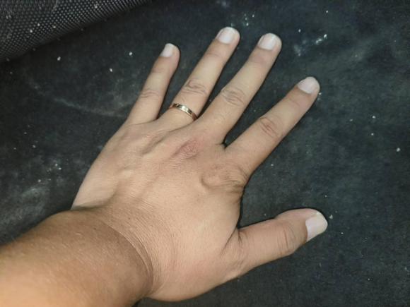 [合肥·皖A] 二手现代劳恩斯-酷派2009款 2.0T 自动靓雅版